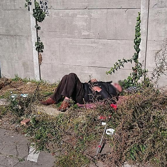 Odchody, wymiociny, robactwo i agresja, czyli codzienny widok w centrum miasta